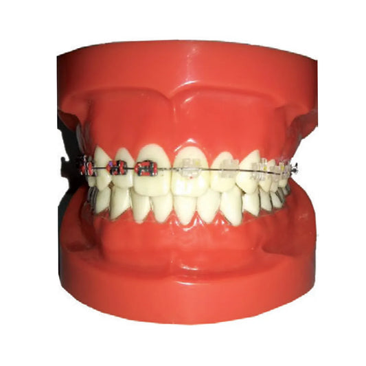 JJ Ortho Half Metal & Half Ceramic Brackets Orthodontic Model (10.10.06)