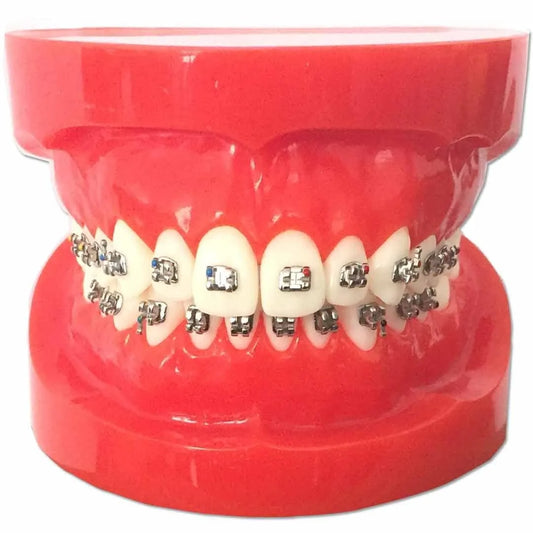 JJ Ortho Class I Orthodontic Model With Metal Brackets (10.10.05)