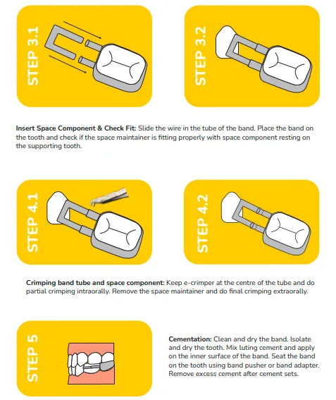 Kids-e-Dental Bands with tube attached Refill