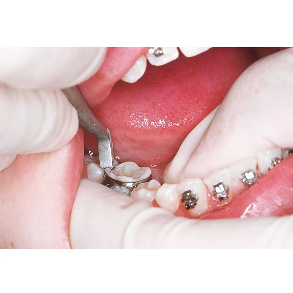 GDC Band Pusher (4870)