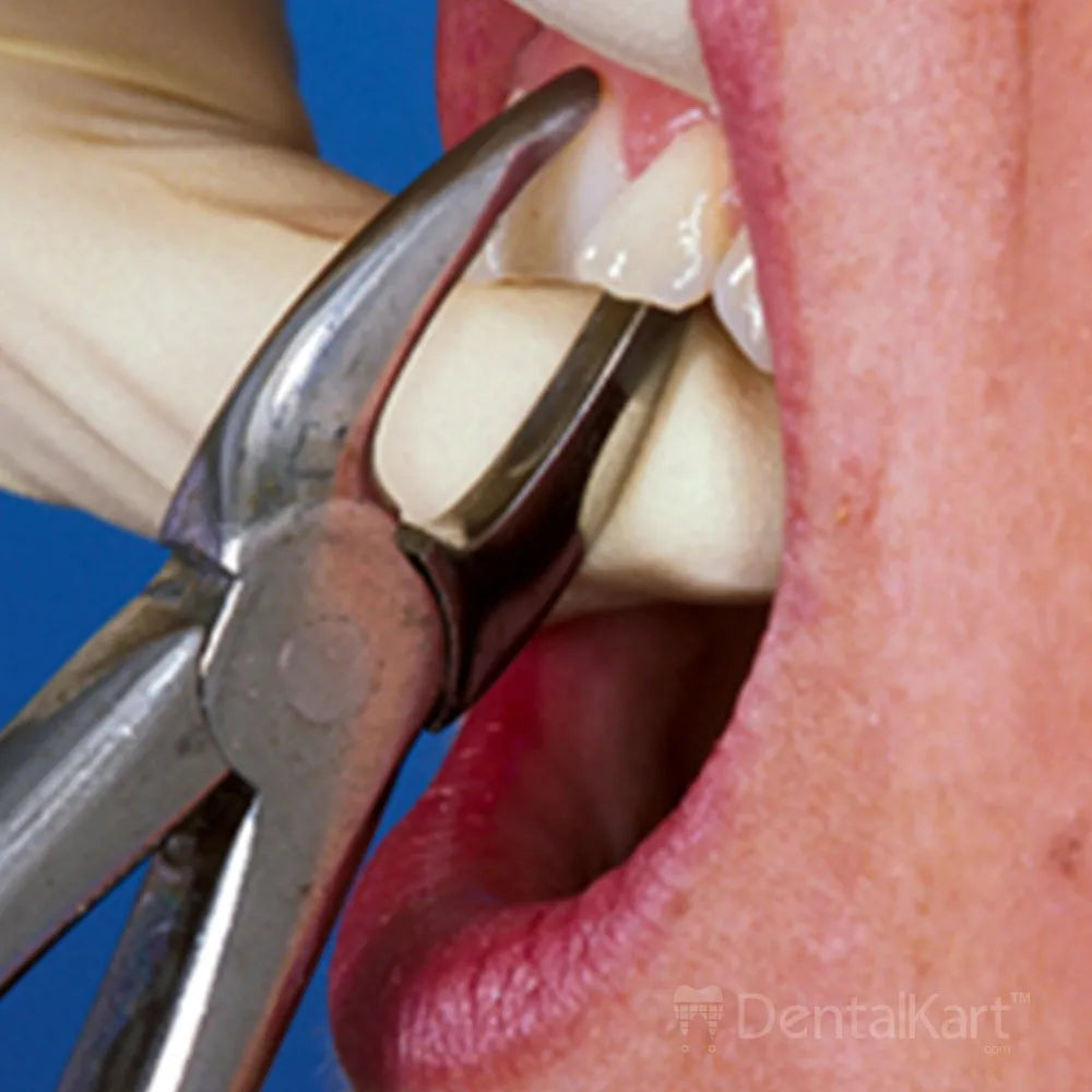 GDC Extraction Forceps Upper Anteriors - 1 Ergonomic (Fx1e)