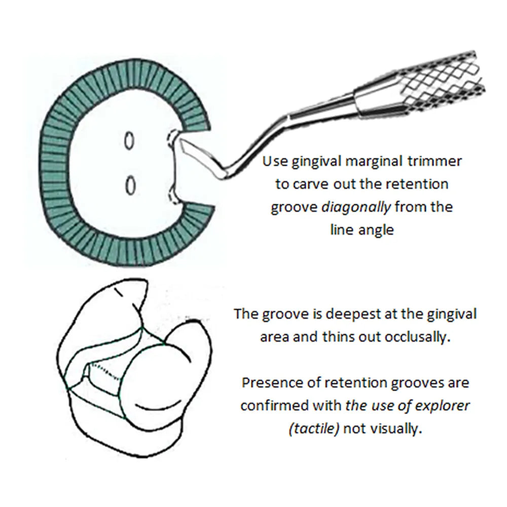 GDC Margin Trimmer -6 (Mt27h)
