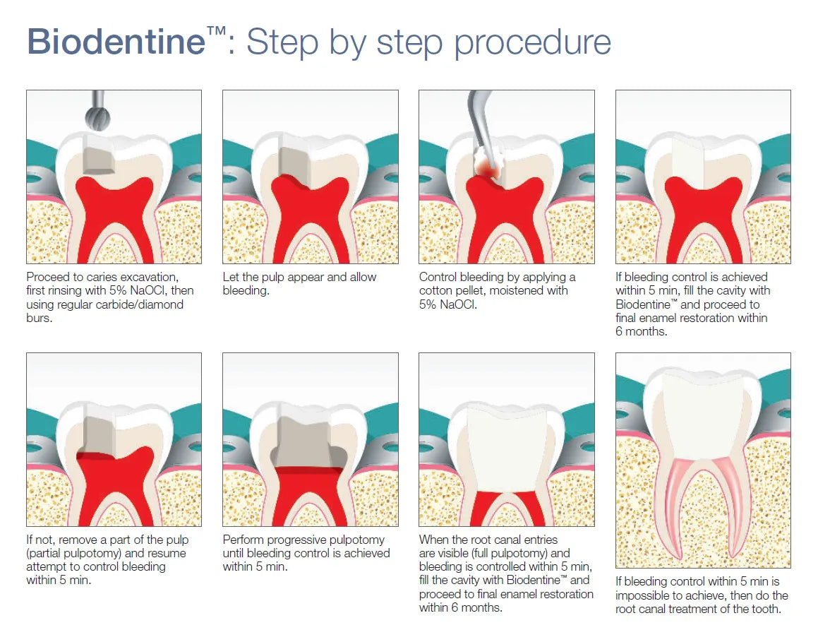 Septodont Biodentine(Single Pouch)