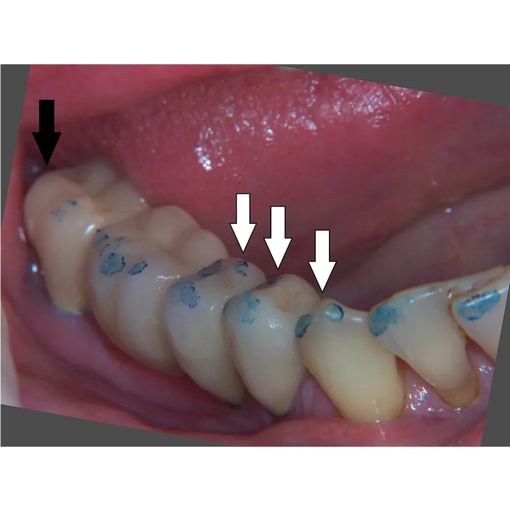 ET Dental Articulating Paper