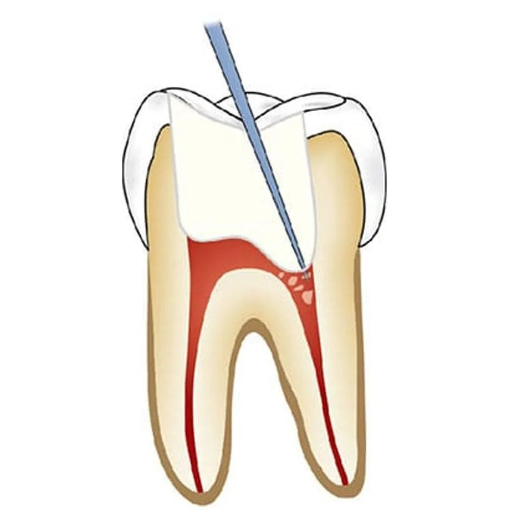 GDC Endo Explorer DG 16-1 (EXDG16)