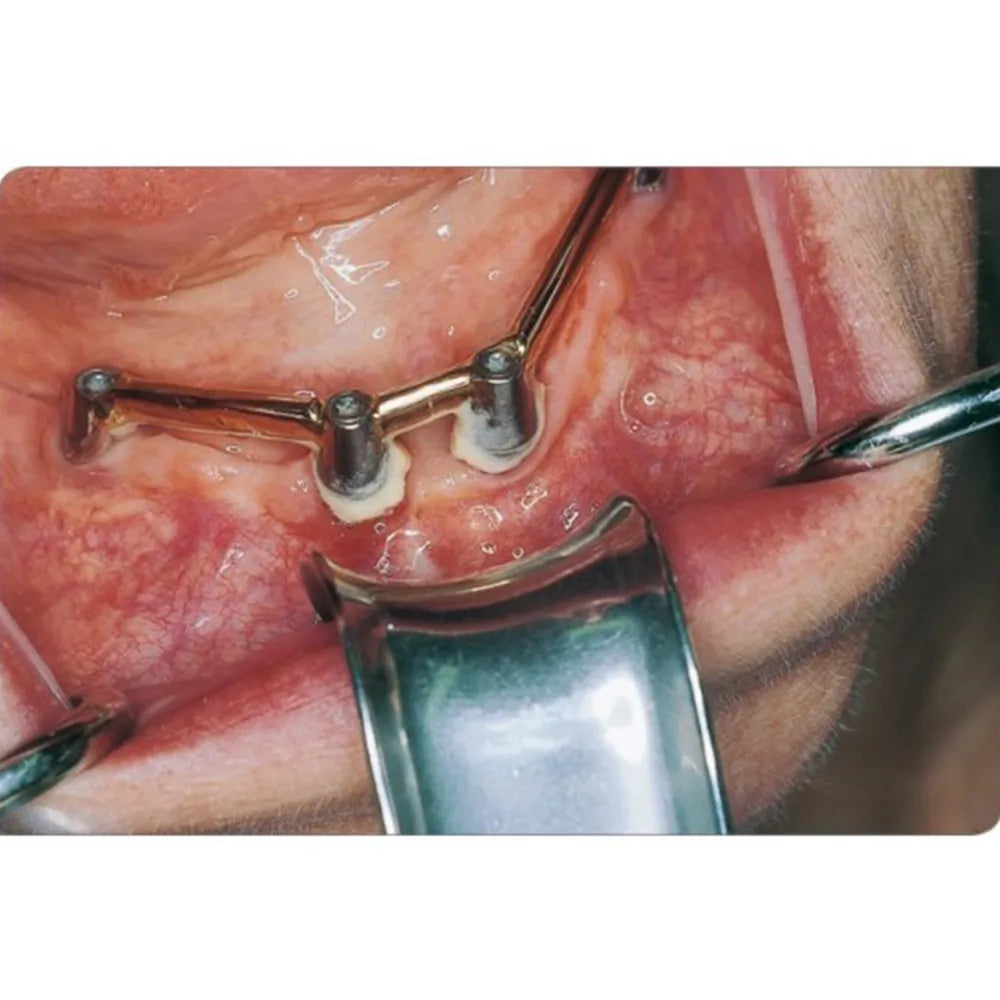 GDC University Of Minnesota Retractor (140mm) CRM