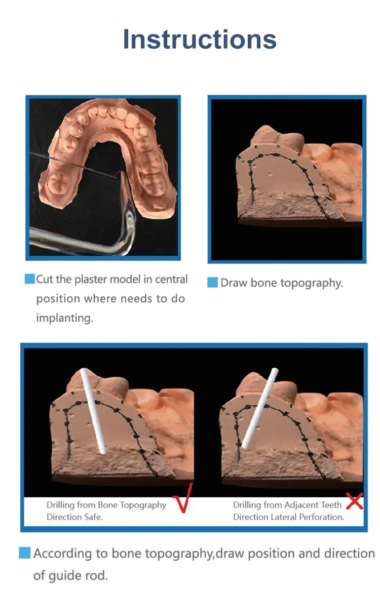 Cotisen Dental Implant Guide System Kit