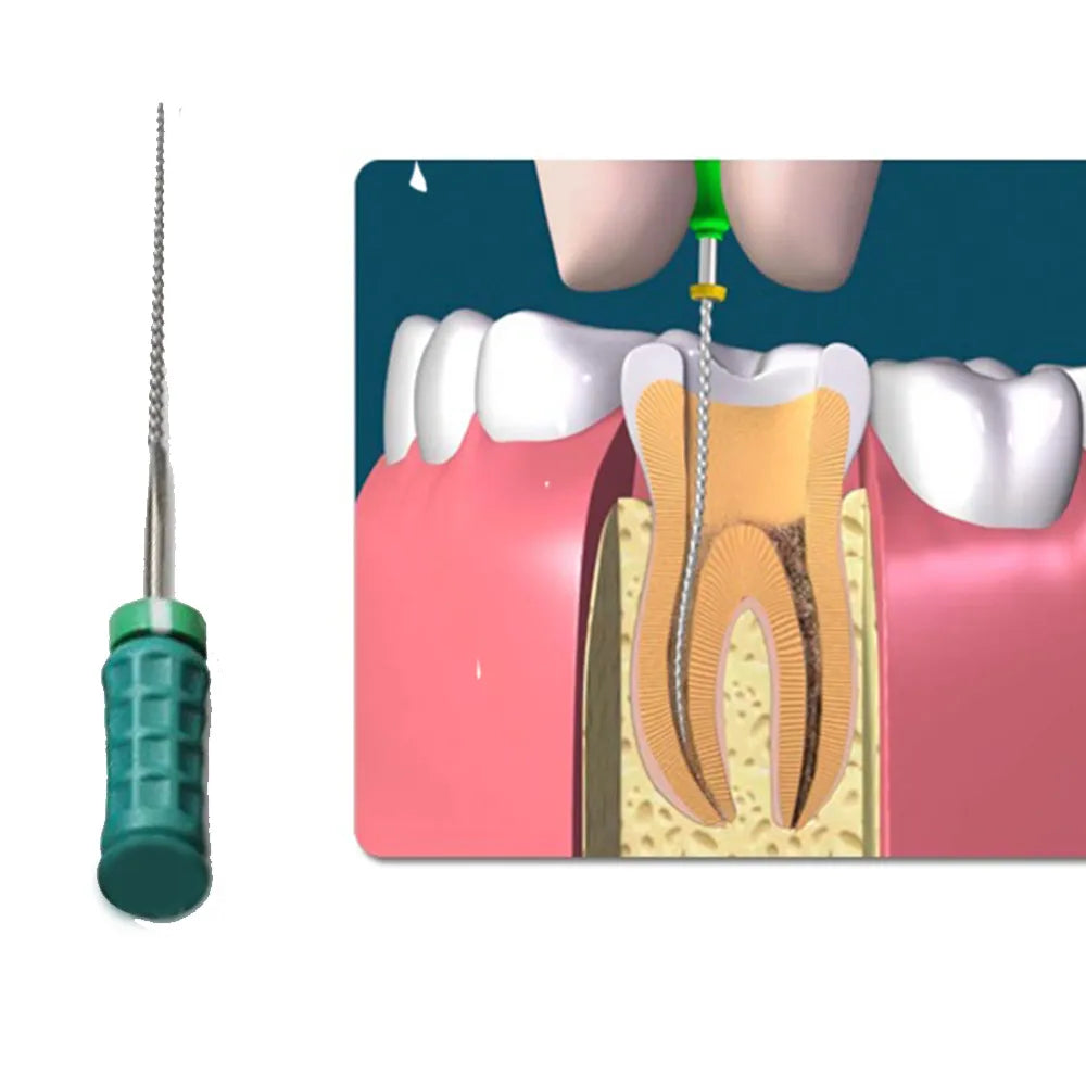 Dentsply M-Access K-Files 25mm (Hand Operated Files)