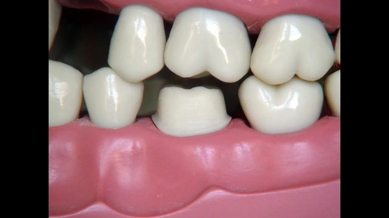 API Typodont Teeth Set with Screw