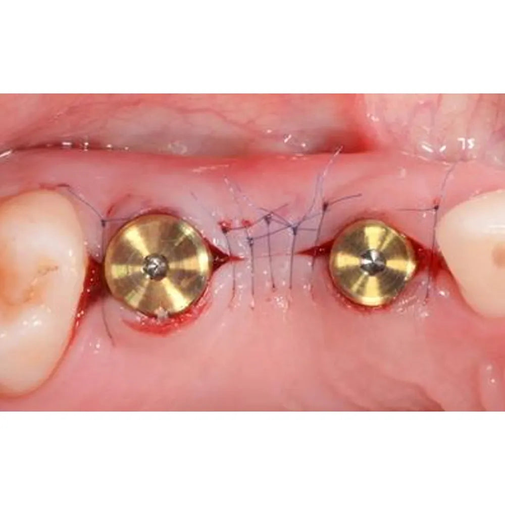 Adin CloseFit NP Slim Healing Abutment 3mm