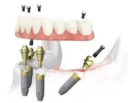 Adin CloseFit NP Straight TMA Abutment