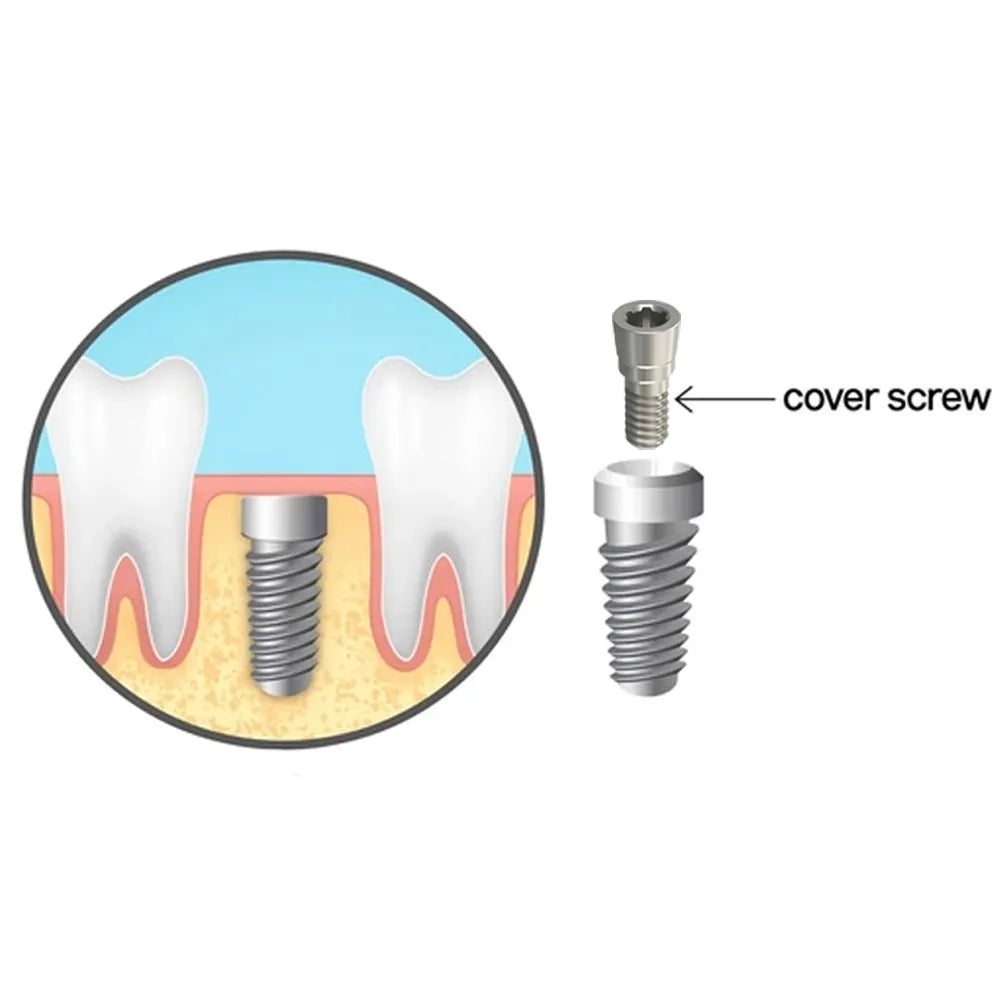 Adin CloseFit UNP Implant Conical Cover Screw (UNP0073)