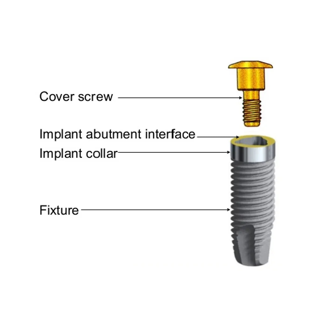 Adin RS Implant Cover Screw (RS3435)