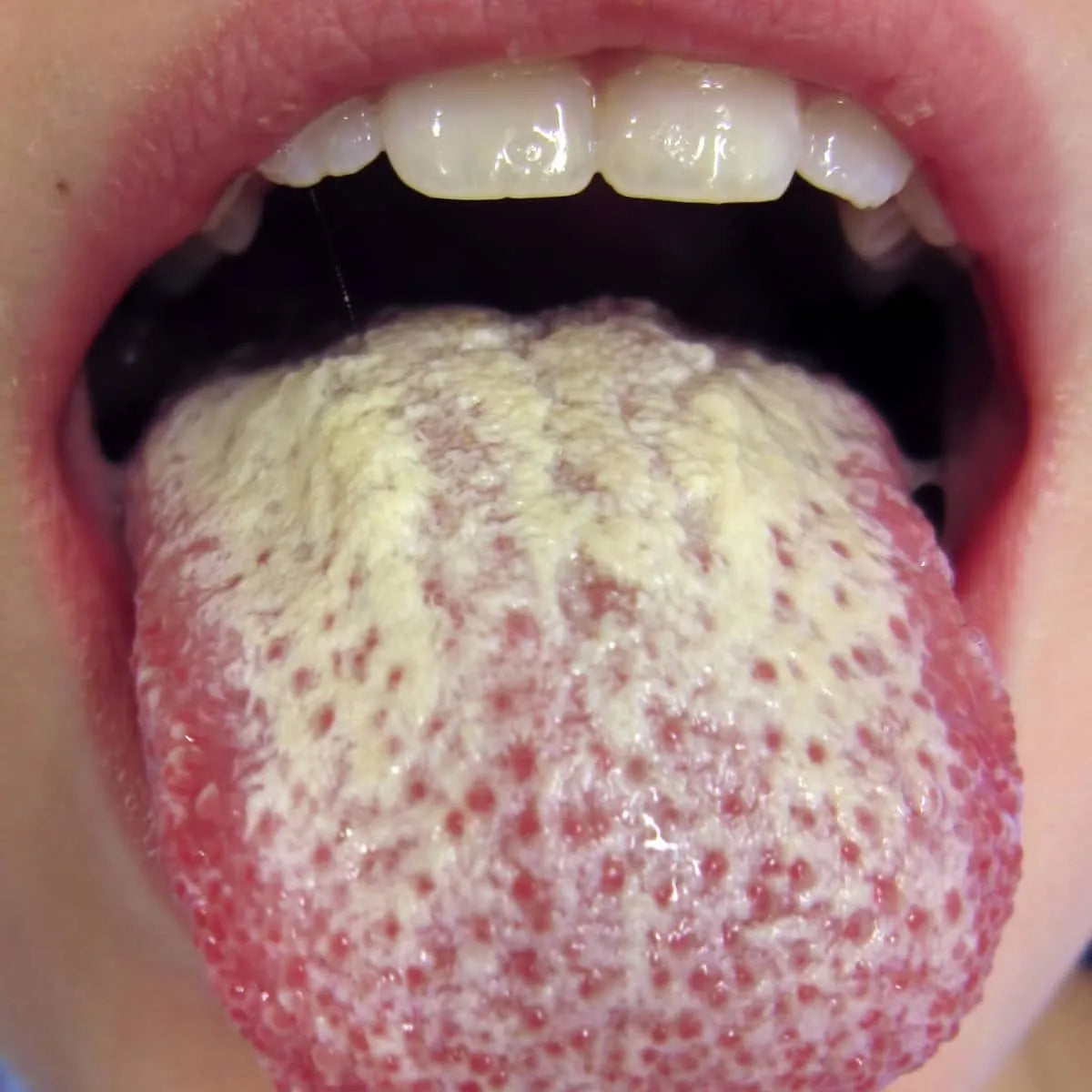 Dr. Morepen Candifung Mouth Paint