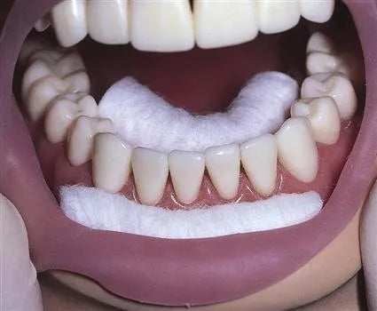 ET Dental Cotton Rolls (Pack of 1000pcs)