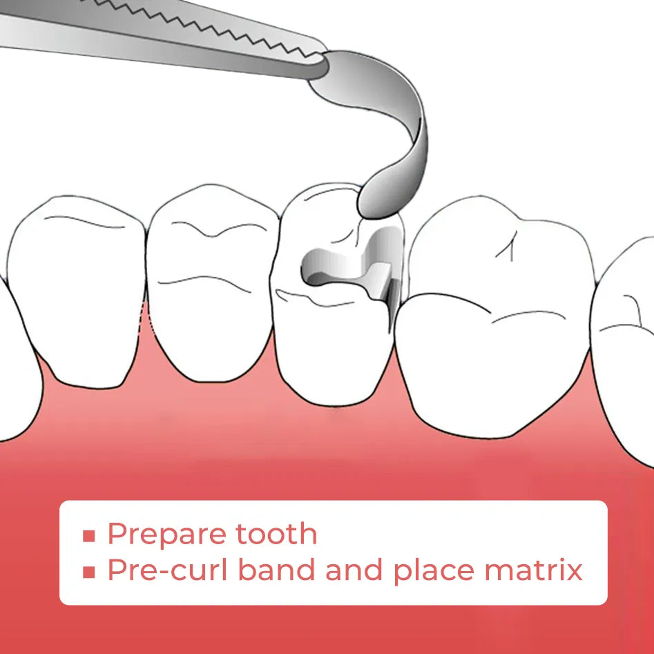 ET Dental Sectional Contoured Matrices Kit