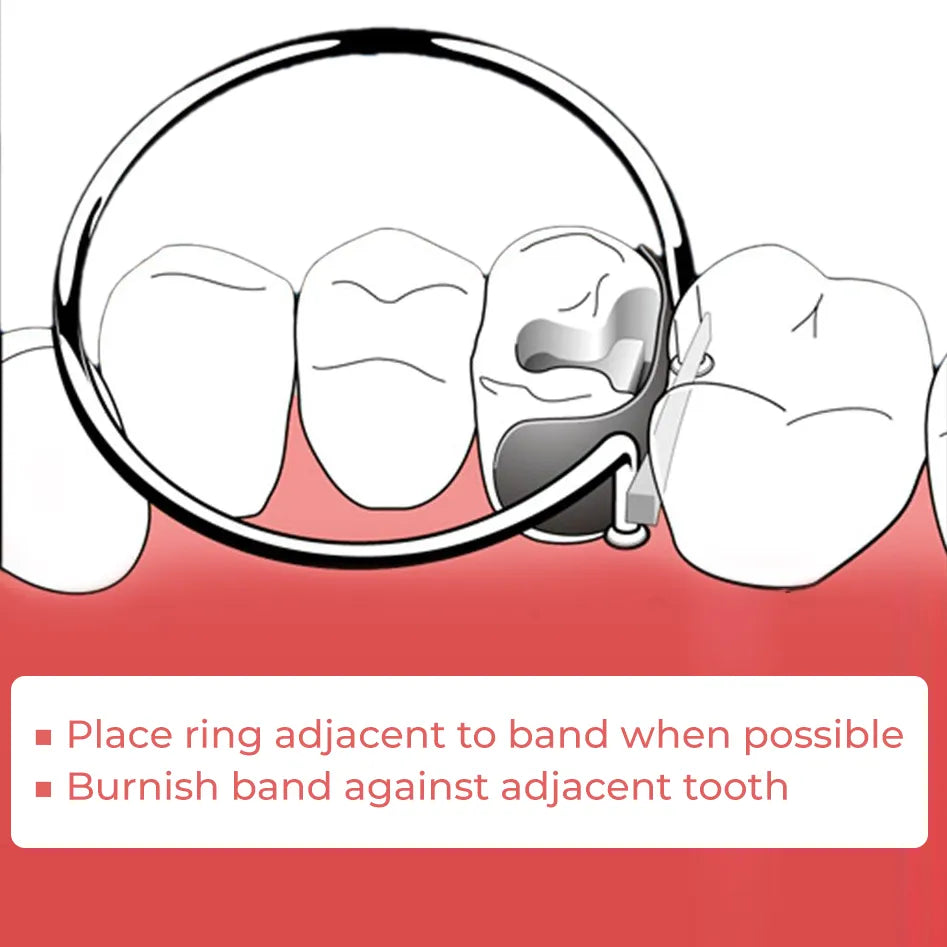 ET Dental Sectional Contoured Matrices Kit