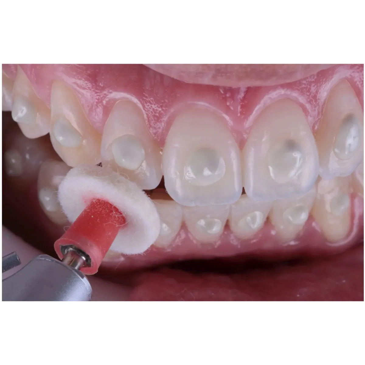 FGM Diamond Master Finishing & Polishing Kit