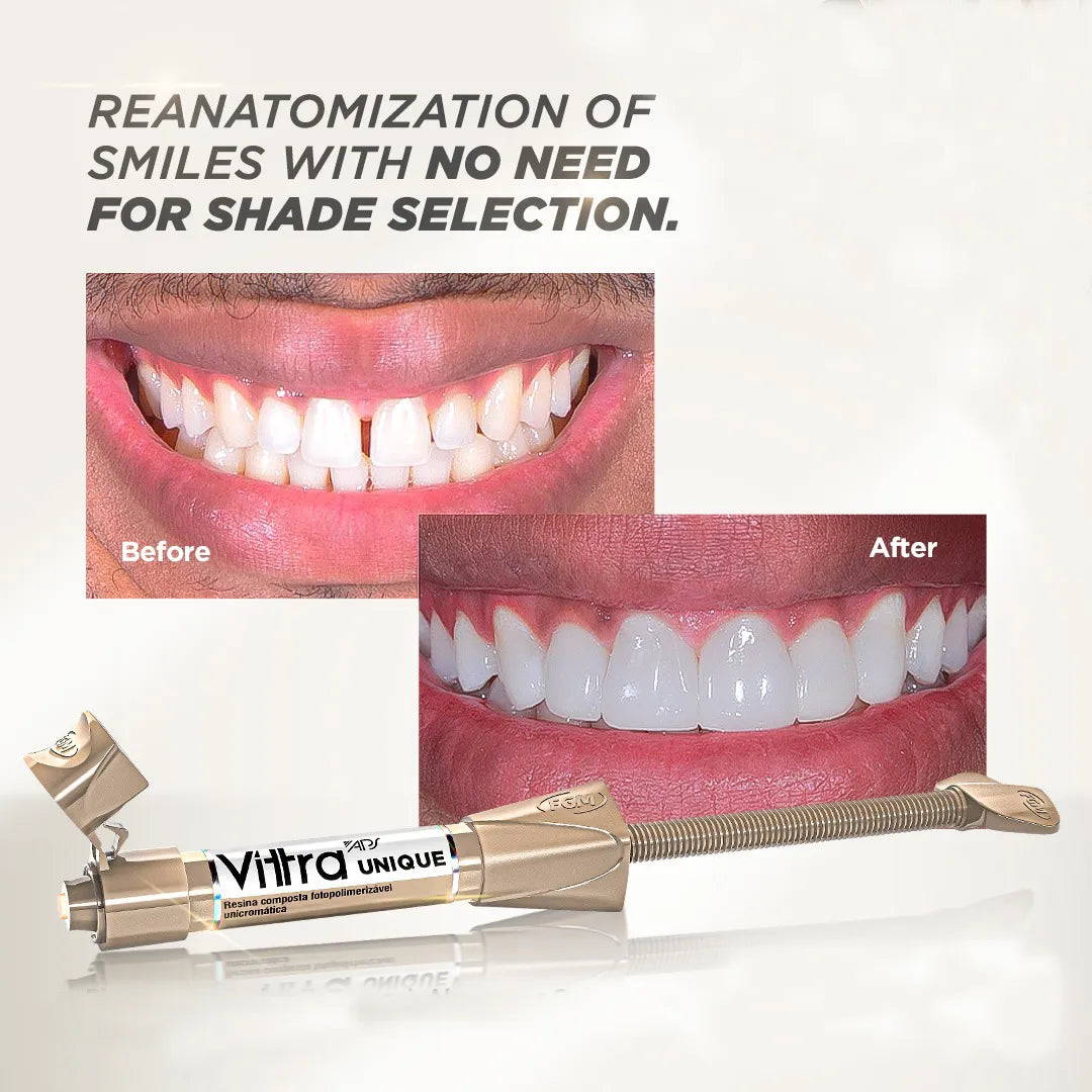 FGM Vittra APS Unique Composite