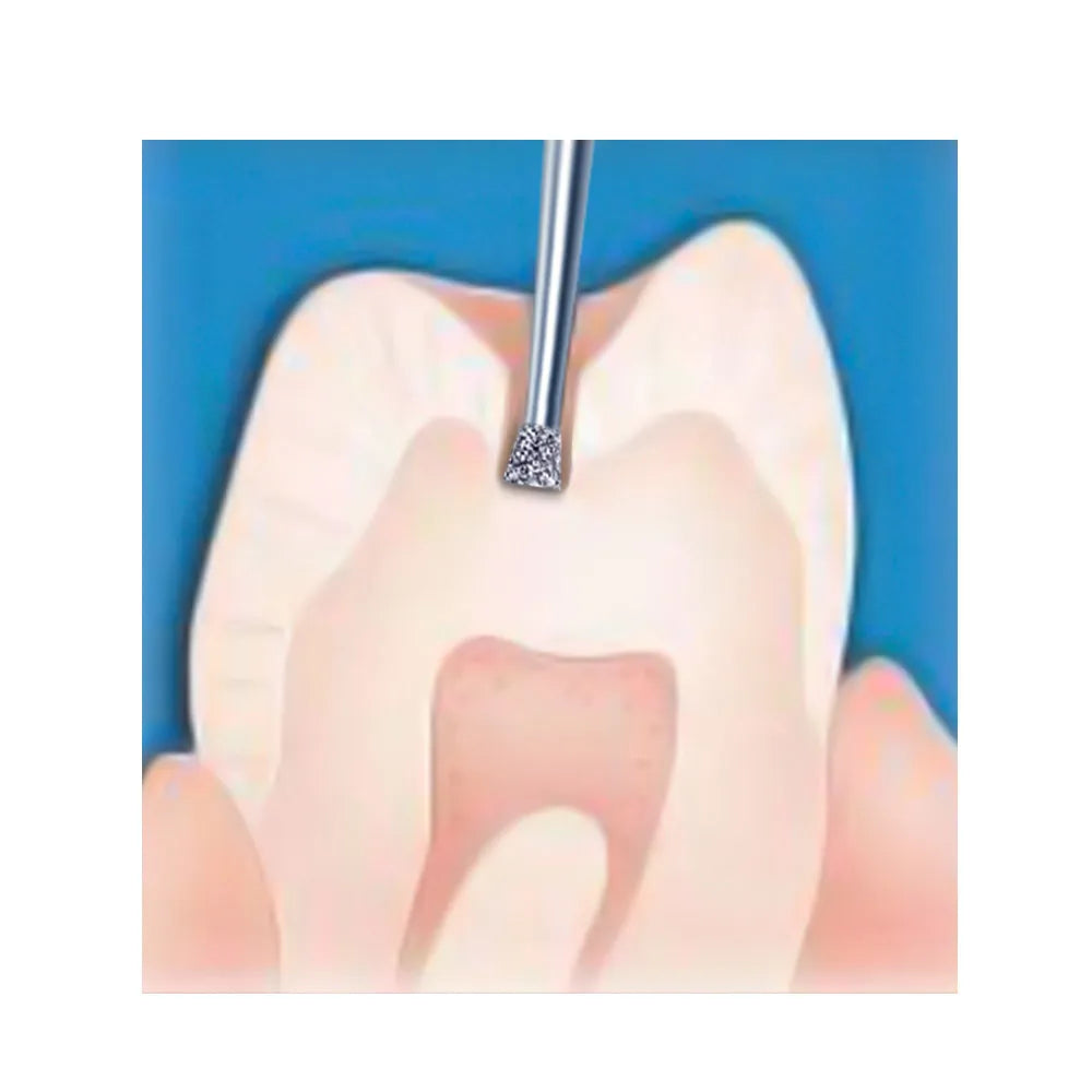 Frank Dental Cavity Preparation Bur -Straight Inverted Cone SI-48