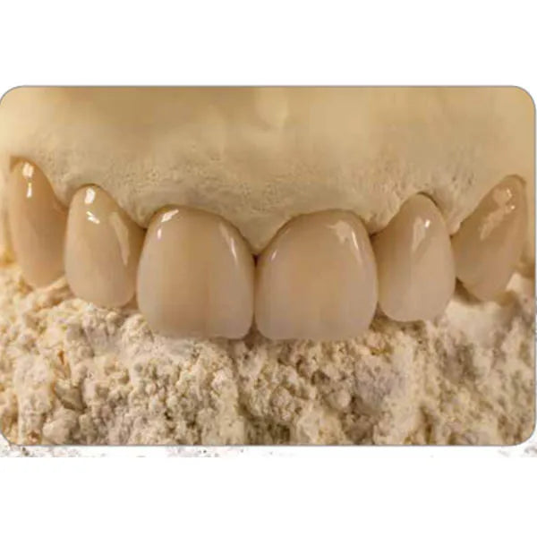 GC Fuji Rock Ep Golden Brown 5kg