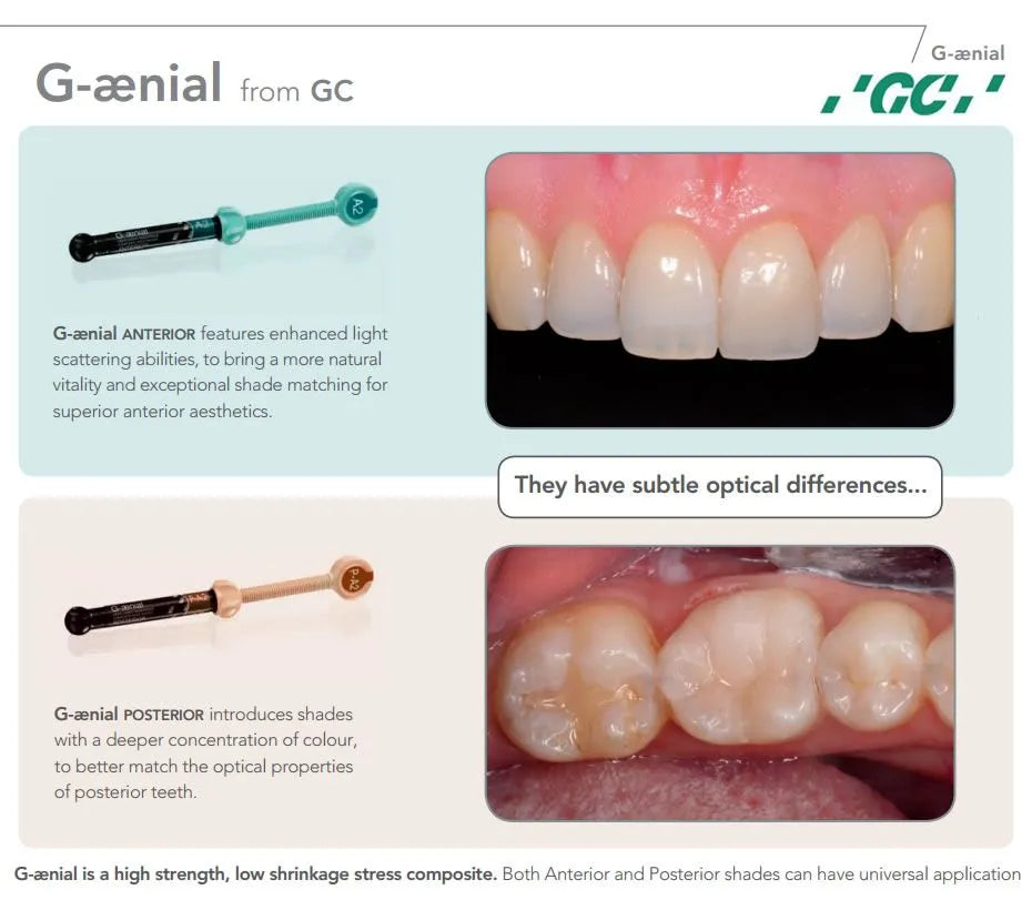 GC G-Aenial Anterior