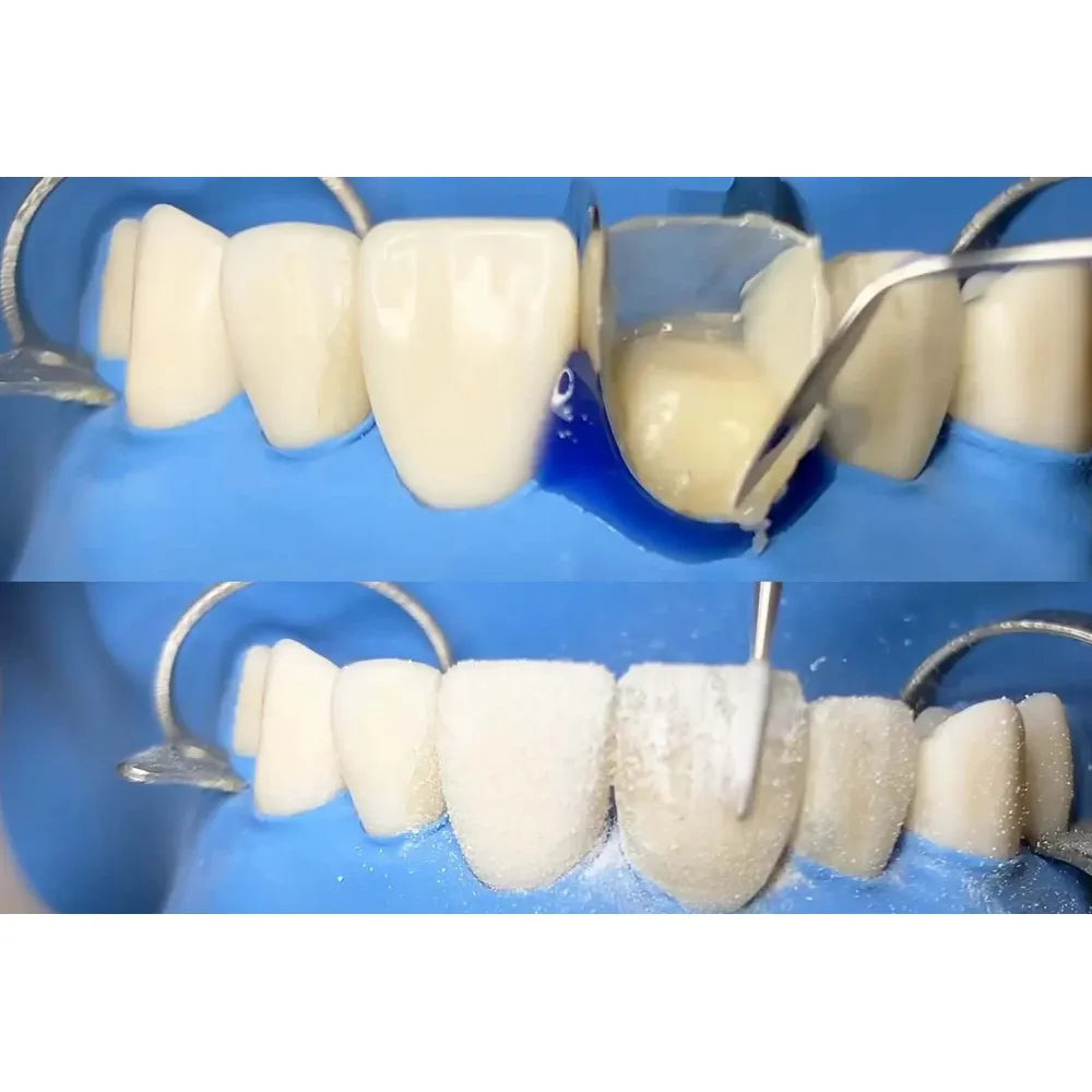 GDC Carver Ward - 4 (Cvwr1s)