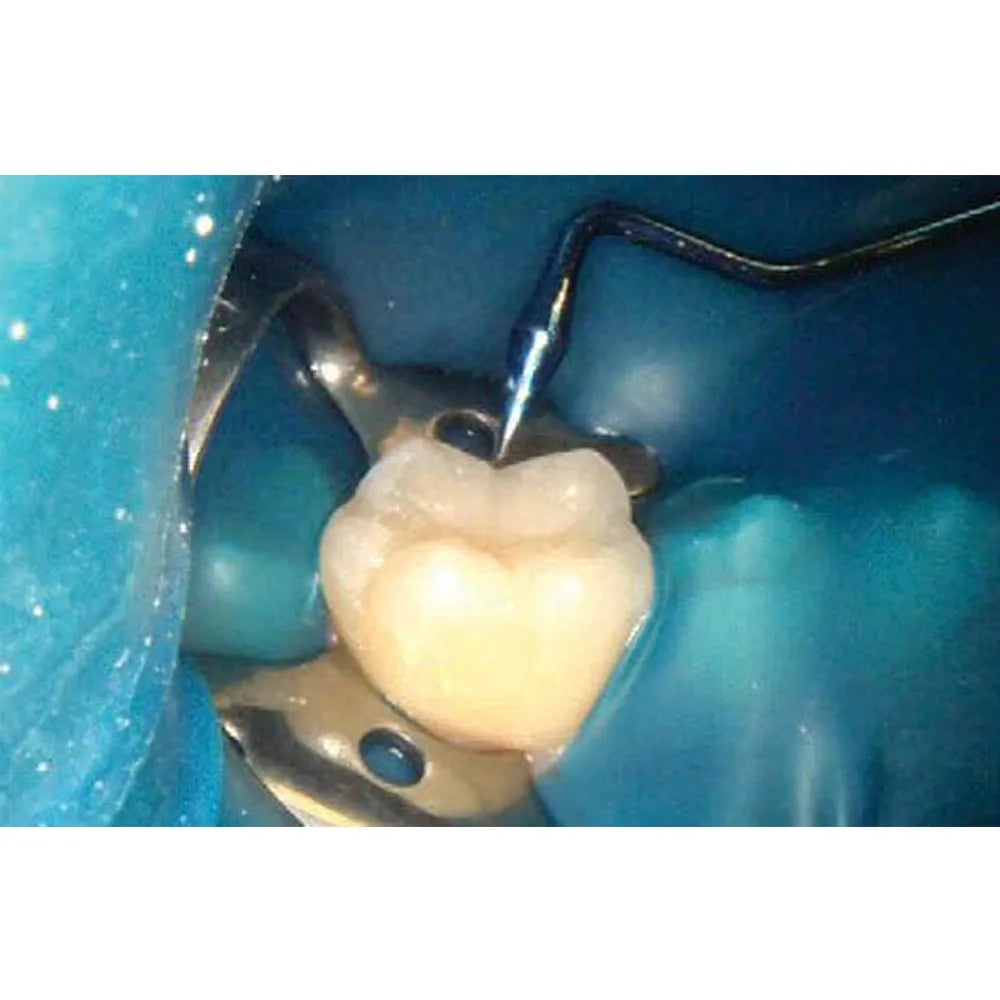 GDC Composite Instrument Blue Titanium - 6 (CIB3)