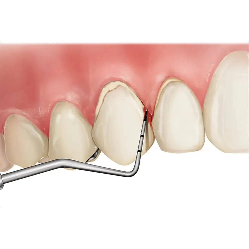 GDC Explorer With PCP11.5B #6 (EXP23/11.5B)