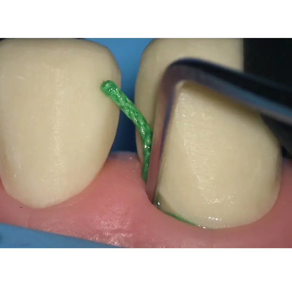 GDC Gingival Cord Packer Non-Serrated #4 (Gcp113n)