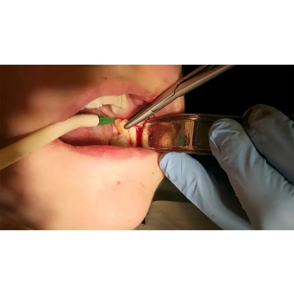 GDC Kilner Retractor C Shape (KRC)