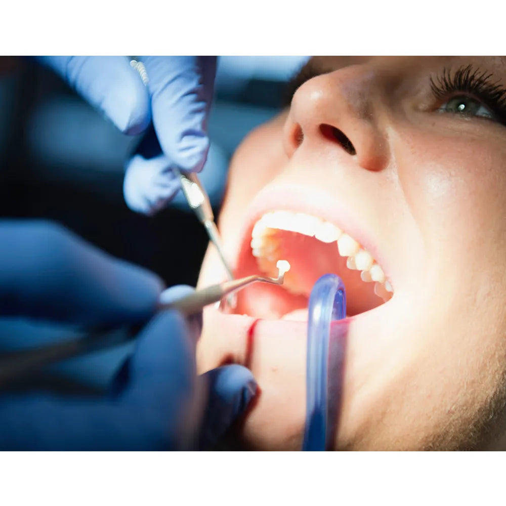 GDC Plastic Filling Instrument - 4 (PF2)
