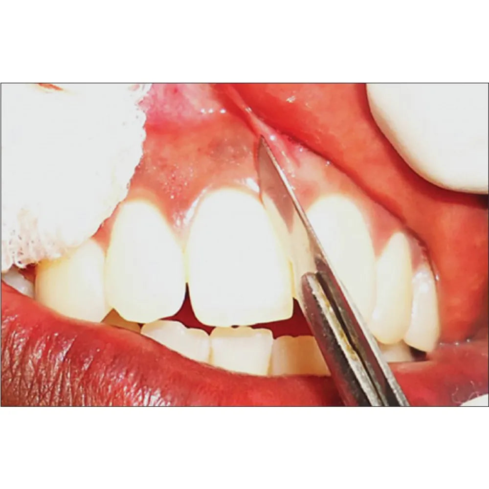 
GDC Scalpel Solid Curved Handle 14.5cm (10-130-5AE)
