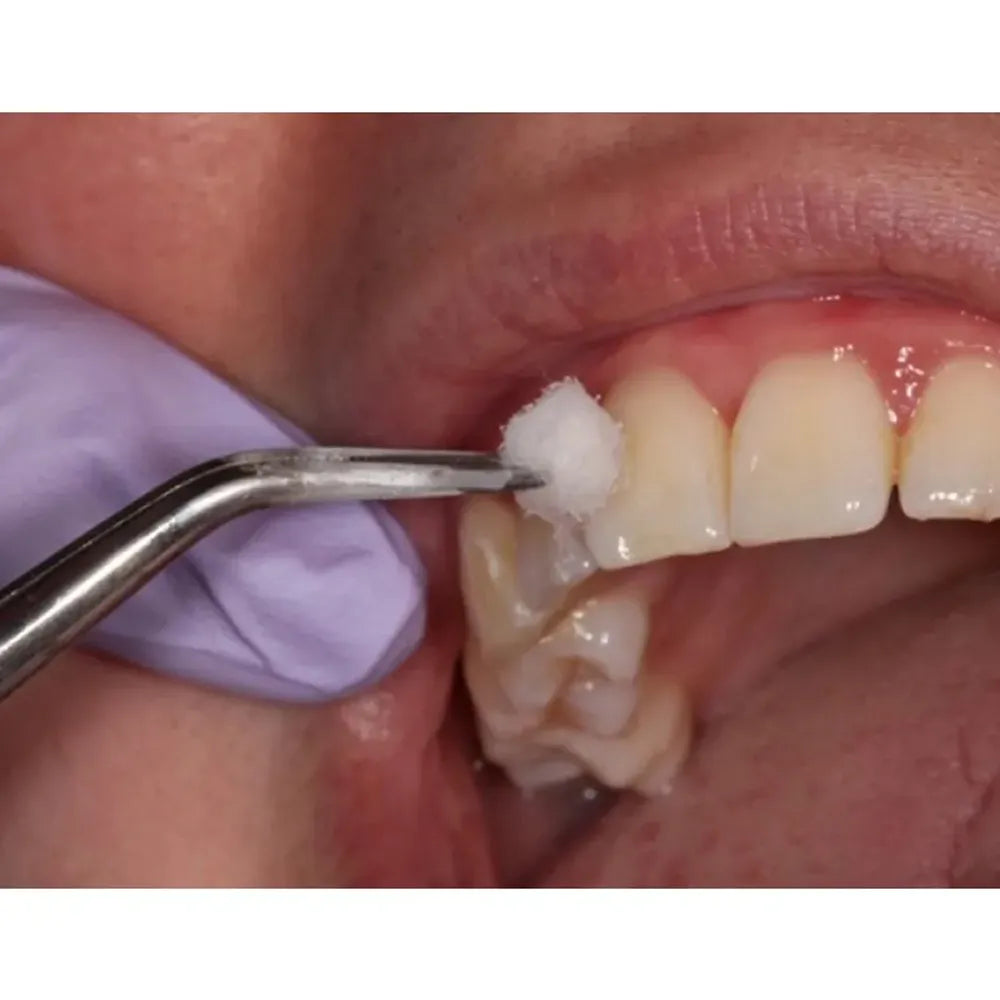 GDC Self Locking Tweezer - Premium (Dp18l)