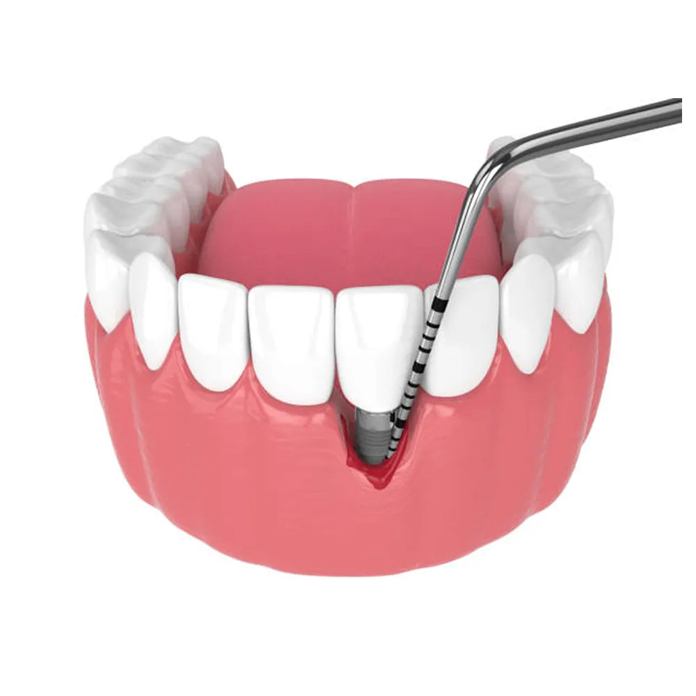 GDC Single End Probes University Of North Carolina #6 (Pcpunc15)