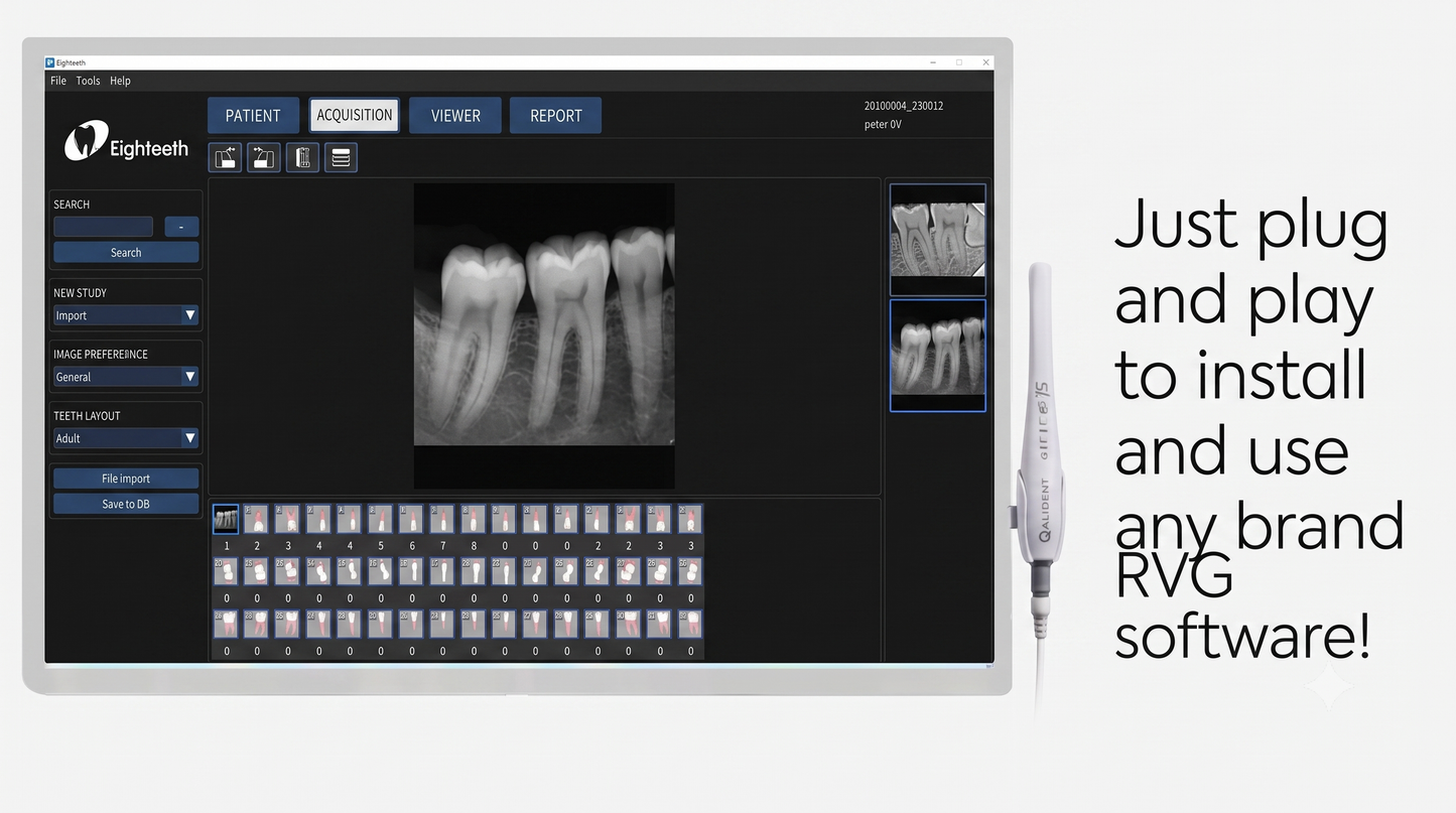 Qualdent Intra Oral Camera With Touch Screen - All In One Computer