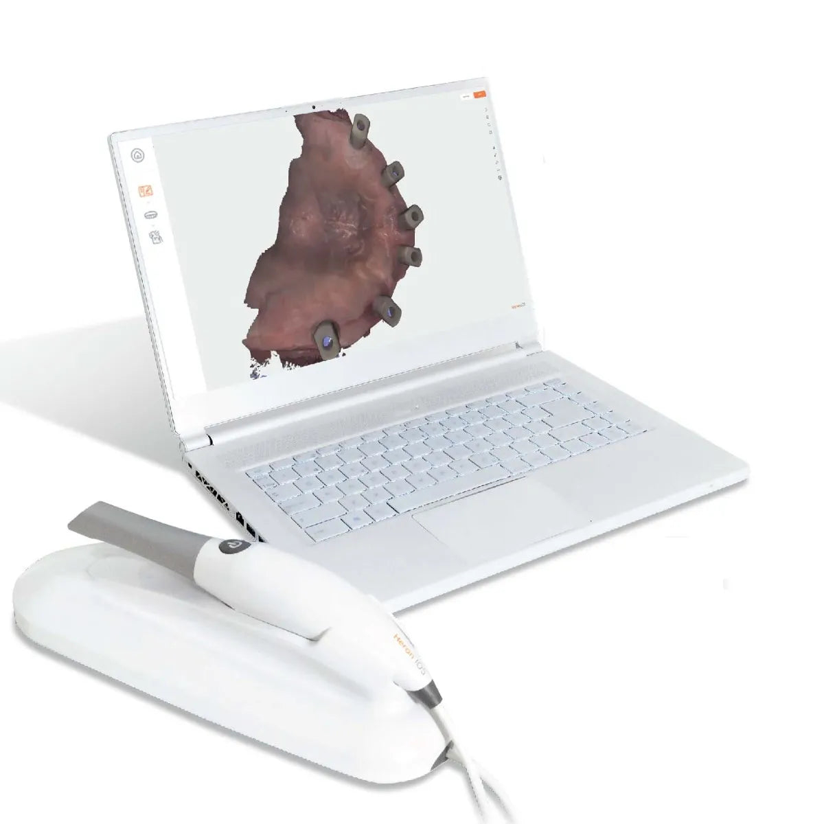 Heron Intraoral Scanner