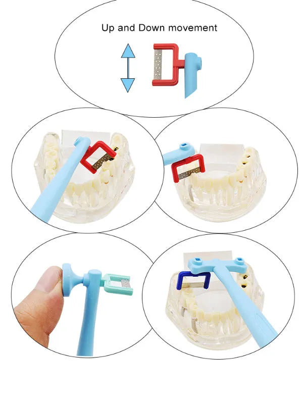 Interproximal Enamel Reduction KIT