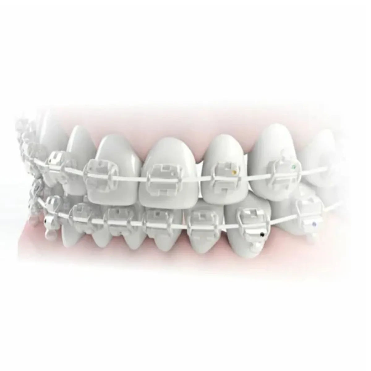 JJ Ortho Tooth Colored NiTi Archwires - Round