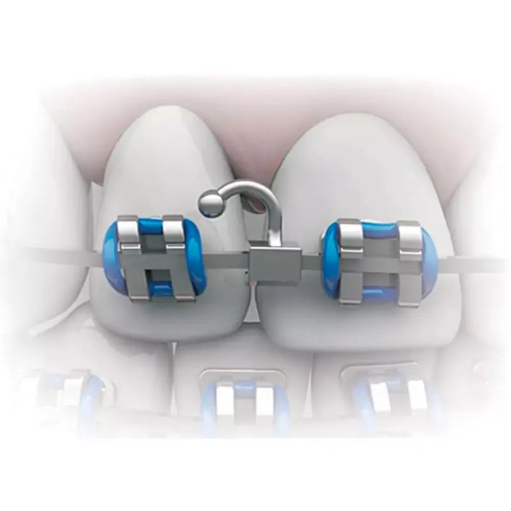 JJ Ortho Crimpable Ball Hooks Curved