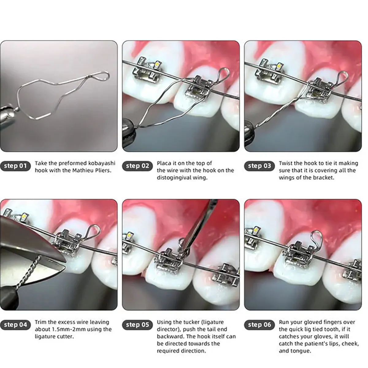 
JJ Ortho Kobayashi Ligatures Wires