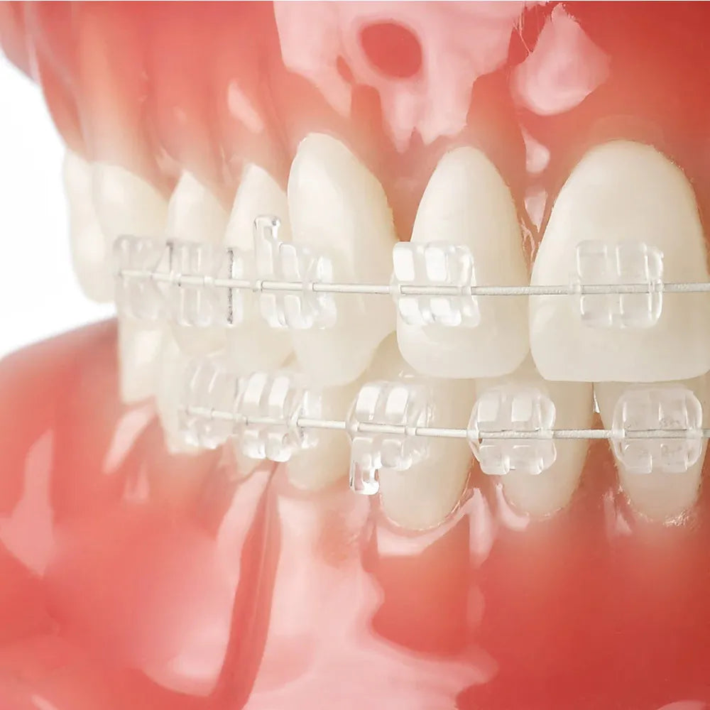 JJ Ortho Tooth Colored Stainless Steel Archwires - Rectangular