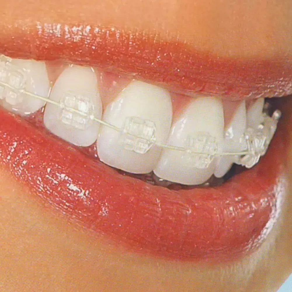 JJ Ortho Tooth Colored Stainless Steel Archwires - Rectangular