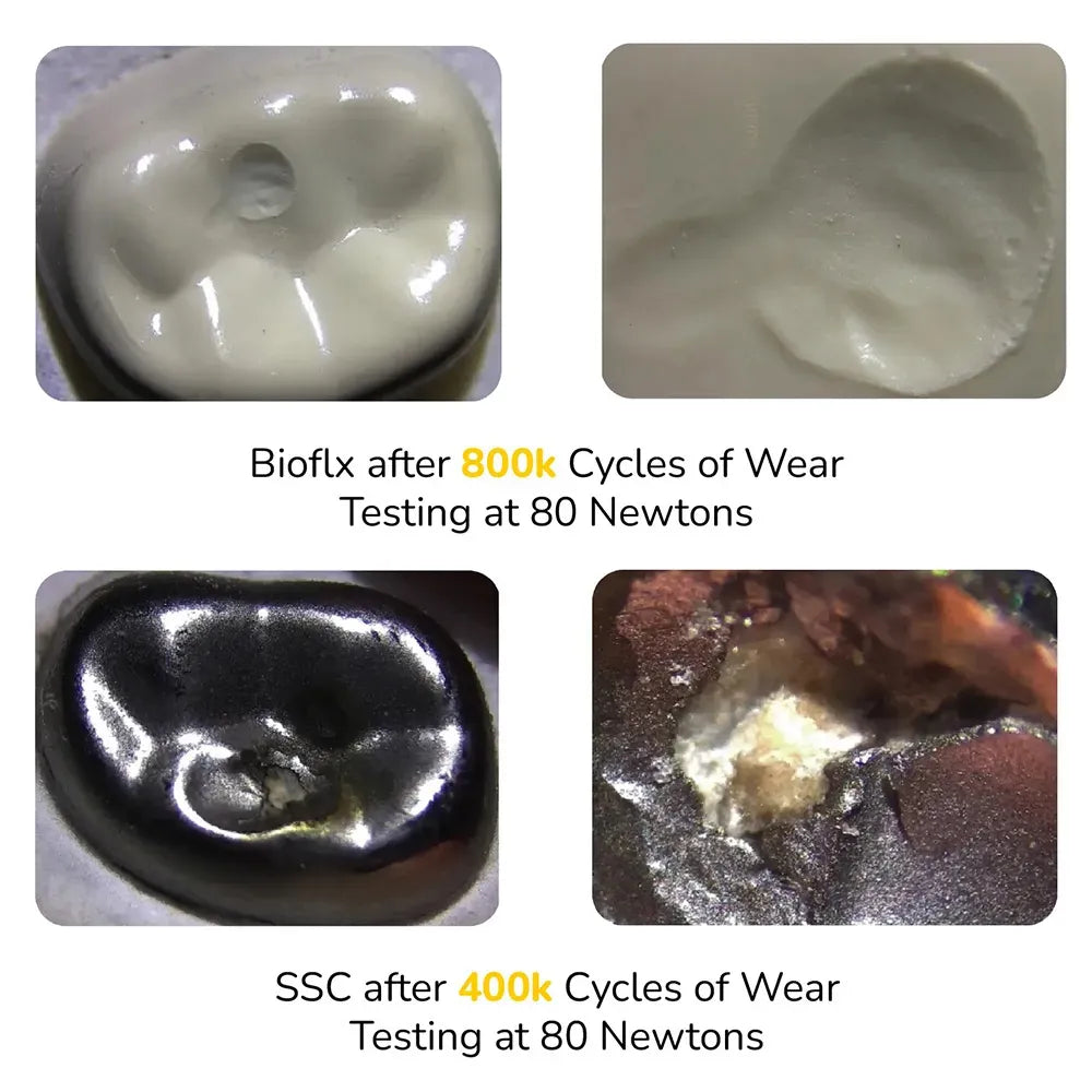 Kids-e-Dental BioFlx Lower Left 2nd Molar Crowns Refills