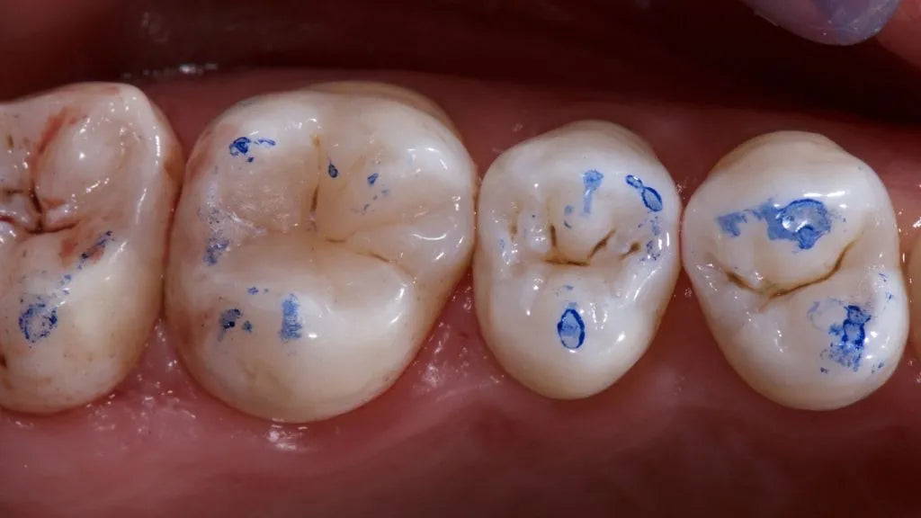 Maarc Articulating Paper - 40µ Microns & 100µ Microns