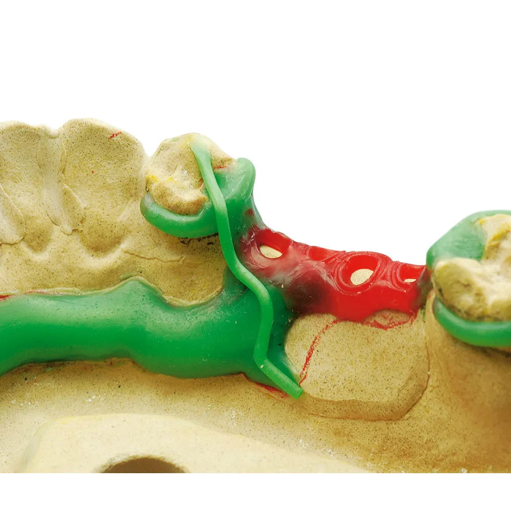 Maarc Clasp Profile Waxes