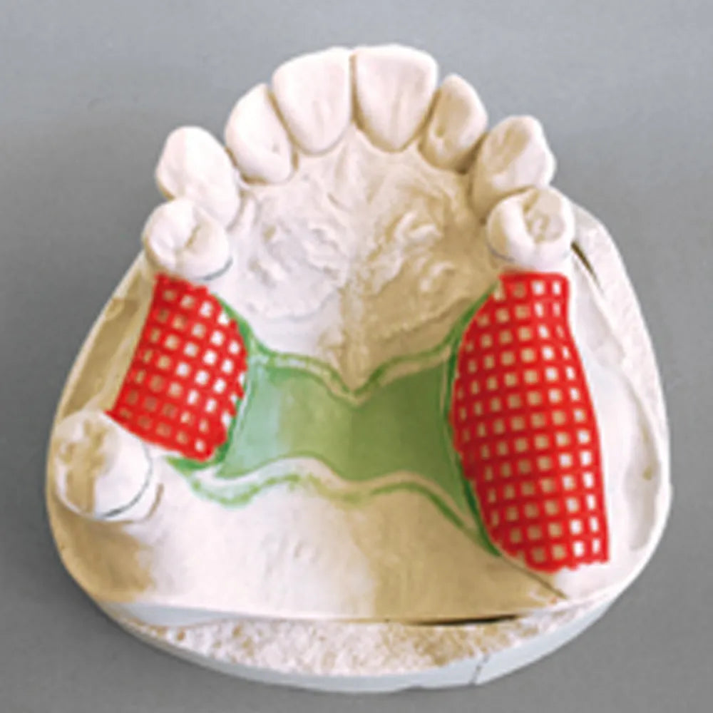 Maarc Retention Mesh