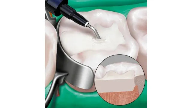 Mani Bulk Fill Universal Composite