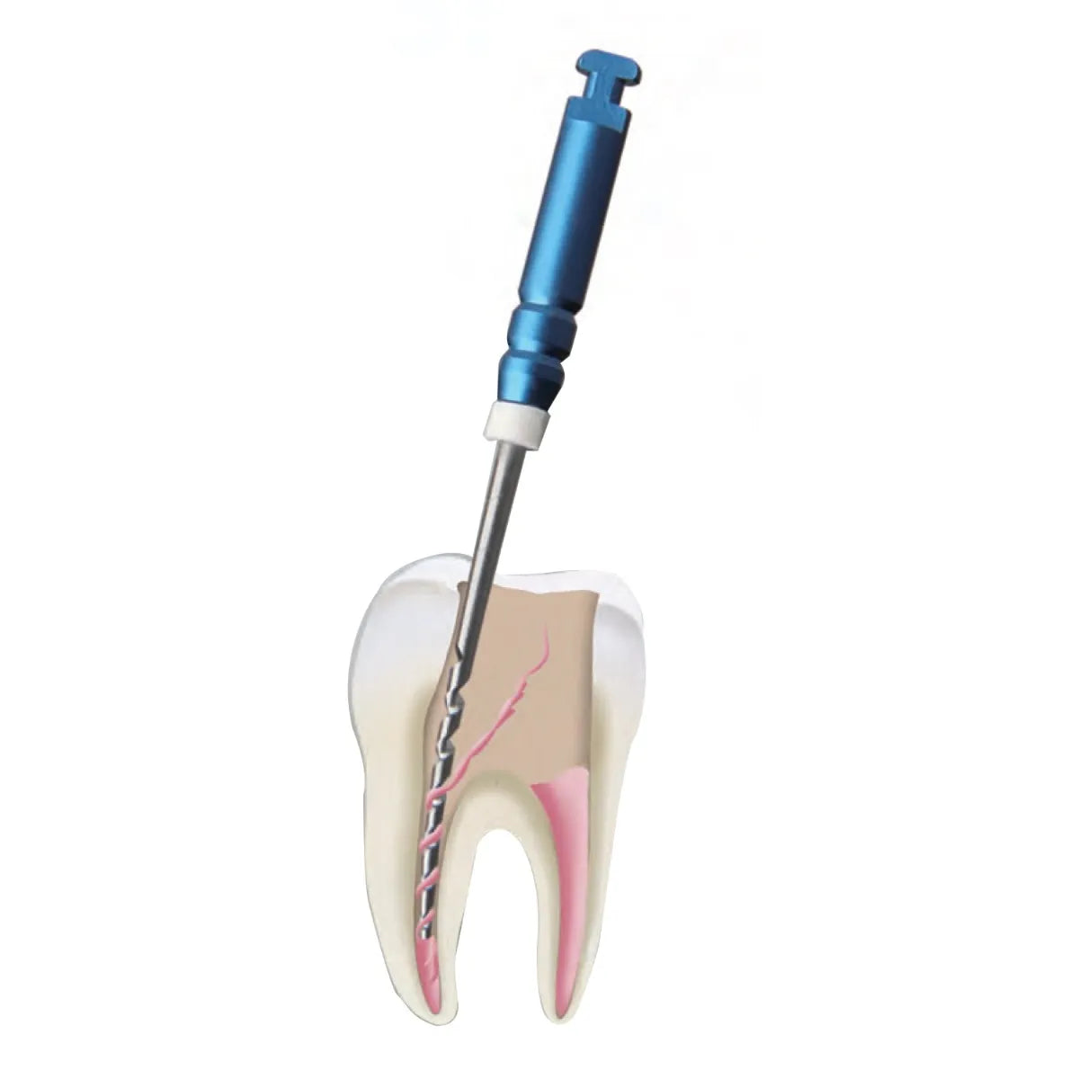 Mani GPR File Assorted 1S-4N