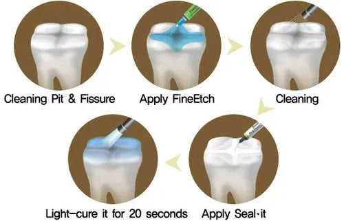 Medicept Protec Pit and Fissure Sealant